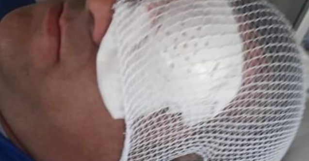 İranlı zorbalar, Türk TIR şoförünü kör etti