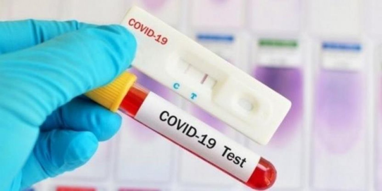 Gürcistan girişlerinde PCD test zorunluluğu 1 Mart’ta kalkıyor